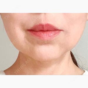 ROHE CLINIC GINZA口コミ