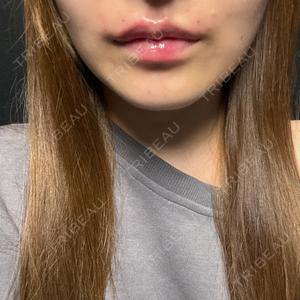R Beauty CLINIC 名古屋院口コミ