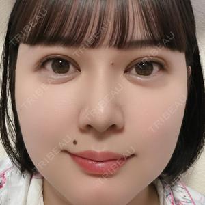 ルラ美容クリニック 広島院口コミ