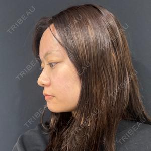 HAAB BEAUTY CLINIC 名古屋院口コミ