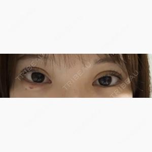 湘南美容クリニック 千葉センシティ院口コミ