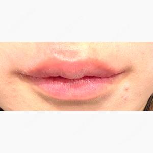R Beauty CLINIC 名古屋院口コミ