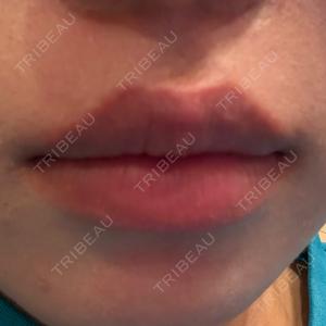 BITO BEAUTY CLINIC口コミ