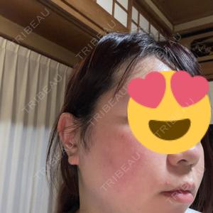 ルラ美容クリニック 神戸院口コミ