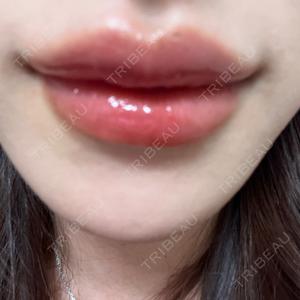 DMTC美容皮膚科 大宮院口コミ
