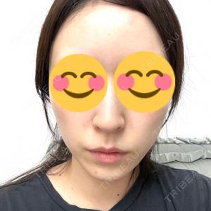 Wi Clinic （ウィ クリニック）心斎橋院口コミ
