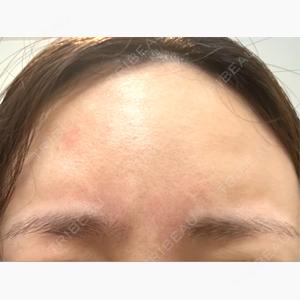 CLEAN BEAUTY CLINIC TokyoAzabu口コミ