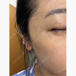 渋谷あおぞらクリニック美容外科・美容皮膚科口コミ