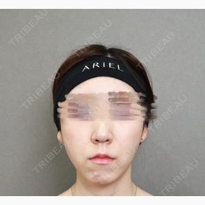 アリエル美容クリニック 大宮院口コミ