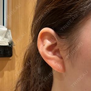 R Beauty CLINIC 銀座院口コミ