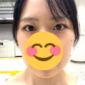 HAAB×DREAM BEAUTY CLINIC 東京本院口コミ