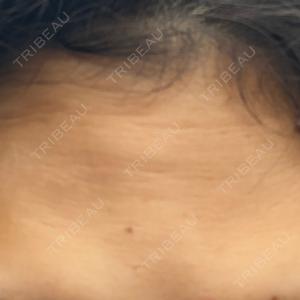 PRO CLINIC プロクリニック 銀座院口コミ
