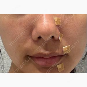 R Beauty CLINIC 名古屋院口コミ
