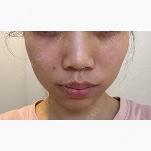 BAO CLINIC 神戸院口コミ