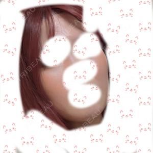 TCB東京中央美容外科 静岡院口コミ