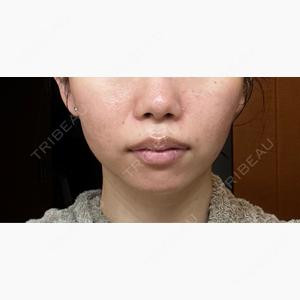 ルラ美容クリニック 京都院口コミ