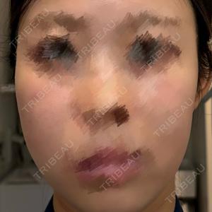 ルラ美容クリニック 京都院口コミ