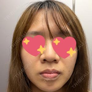HAAB×DREAM BEAUTY CLINIC 東京本院口コミ