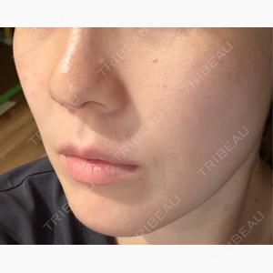 NARU SKIN Beauty Clinic口コミ