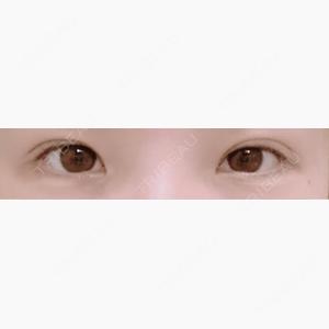 アリエル美容クリニック 郡山院口コミ