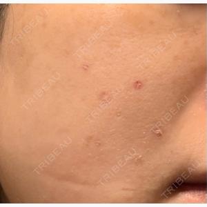 KARIS beauty clinic口コミ