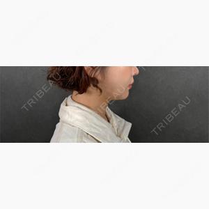新宿美容外科ネビュラクリニック口コミ