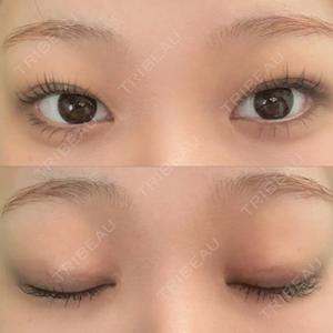 PRO CLINIC プロクリニック 銀座院口コミ