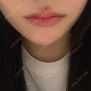 DMTC美容皮膚科 大宮院口コミ