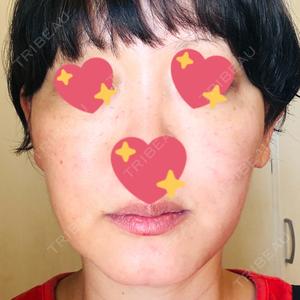 グナル美容外科梅田院口コミ