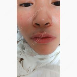 ルラ美容クリニック 新宿院口コミ