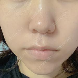 ルラ美容クリニック 高崎院口コミ