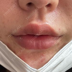 PRO CLINIC プロクリニック 銀座院口コミ