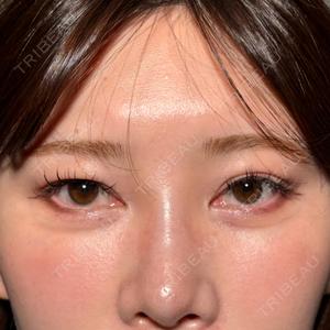 新宿美容外科ネビュラクリニック口コミ
