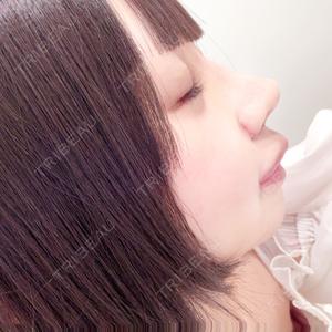R Beauty CLINIC 銀座院口コミ