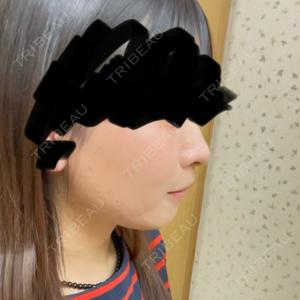 TCB東京中央美容外科 鹿児島院口コミ