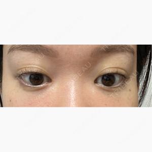 HAAB×DREAM BEAUTY CLINIC 東京本院口コミ