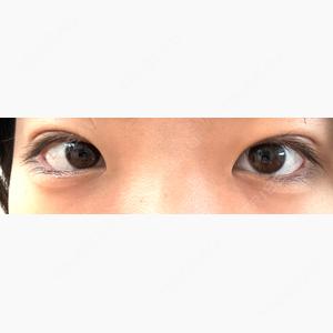 アリエル美容クリニック 大宮院口コミ
