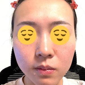 大美会クリニック 梅田院口コミ