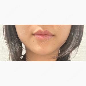 R Beauty CLINIC 名古屋院口コミ