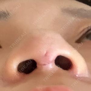 郡山タウン形成外科クリニック口コミ
