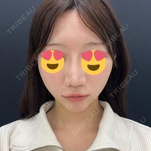 東京シンデレラ美容外科  横浜院口コミ