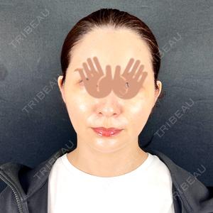 藤・ナチュレ美容クリニック 銀座院口コミ