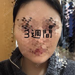 ルラ美容クリニック 池袋院口コミ