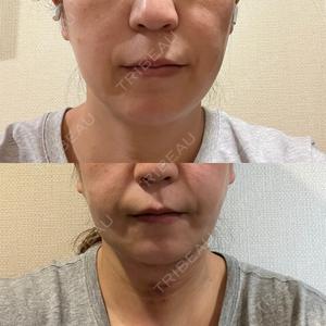 湘南美容クリニック 新橋銀座口院口コミ