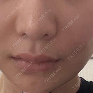 PRO CLINIC プロクリニック 銀座院口コミ