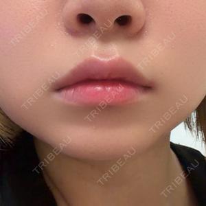 ルラ美容クリニック 大阪本院口コミ