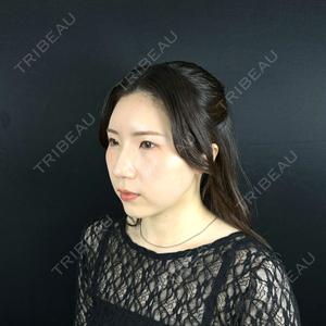 藤・ナチュレ美容クリニック 銀座院口コミ