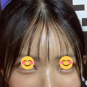 PRO CLINIC プロクリニック 銀座院口コミ