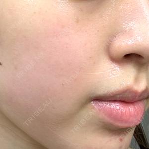 ルラ美容クリニック 札幌大通り院口コミ