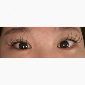 HAAB×DREAM BEAUTY CLINIC 大阪梅田院口コミ